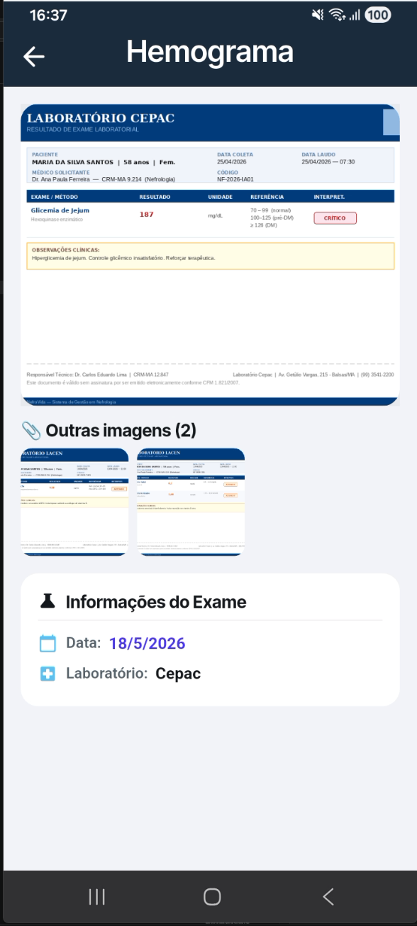 Detalhe de exame no NefroVida
